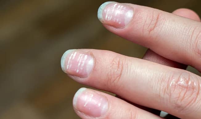 White spot on nails know nail mark sign is lucky or unlucky according to samudrik shastra White Spot on Nails: ਨਹੁੰਆਂ ਦੇ ਇਹ ਨਿਸ਼ਾਨ ਬਿਆਨ ਕਰਦੇ ਨੇ ਤੁਹਾਡਾ ਚਰਿੱਤਰ ਤੇ ਕਿਸਮਤ , ਜਾਣੋ ਕੀ ਕਹਿੰਦਾ ਸਾਮੁਦ੍ਰਿਕ ਸ਼ਾਸਤਰ