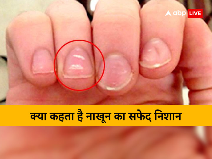 Tips To Strengthen Your Brittle Nails : ಉಗುರುಗಳು ಬಲಹೀನವಾಗಿದೆಯೇ? ಹೀಗೆ ಮಾಡಿ  ಉಗುರಿನ ಆರೋಗ್ಯ ಕಾಪಾಡಿ. - Kannada BoldSky