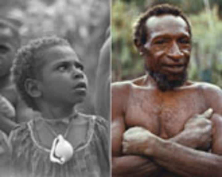 पापुआ न्यू गिनी पाई जानी वाली फोर जनजाति में जब किसी की मृत्यु हो जाती है तो यहां के लोग उसका पित्ताशय छोड़कर दिमाग और पूरा शरीर खा जाए थे.