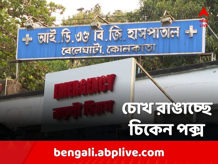 number of cases of chicken pox is increasing in the state, doctors advise to be careful Chicken Pox: রাজ্যে বাড়ছে চিকেন পক্সে আক্রান্তের সংখ্য়া, সতর্ক থাকার পরামর্শ চিকিৎসকদের