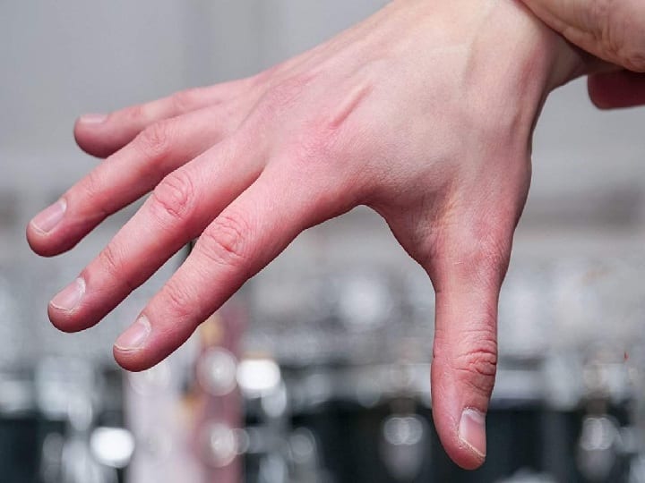 Fingers Swelling in Winter If the fingers are stiff or turning red in