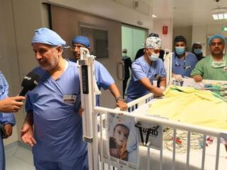 Conjoined Twins: સાઉદી અરેબિયામાં 11 કલાકની સર્જરી બાદ જોડિયા બાળકોને સફળતાપૂર્વક અલગ કરાયા