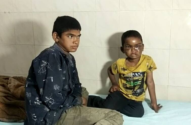 A 4-year-old child was injured by bees in Surat Surat: સુરતમાં 4 વર્ષના બાળકને મધમાખીઓએ માર્યા ડંખ, માતા-પિતાની ગેરહાજરીમાં 10 વર્ષના મોટા ભાઈએ પહોંચાડ્યો હોસ્પિટલે