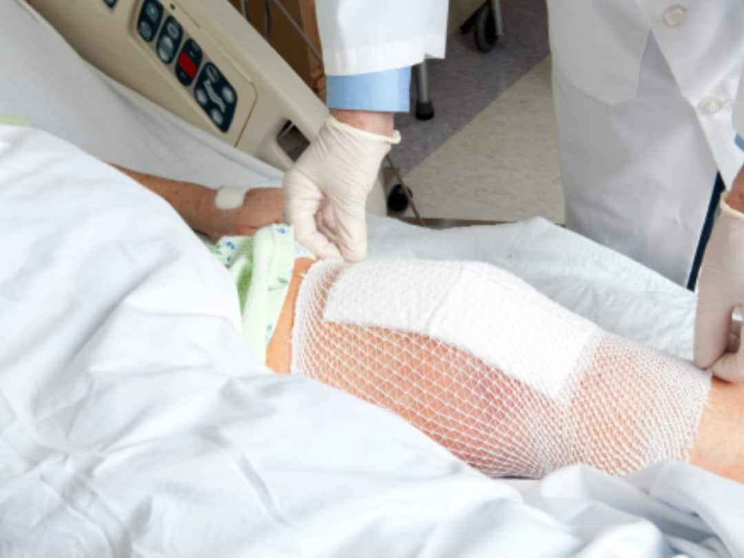 Reasons Why Knee-Replacement Surgery Is Likely The Best Option If You Are Suffering From Osteoarthritis Reasons Why Knee-Replacement Surgery Is Likely The Best Option If You Are Suffering From Osteoarthritis