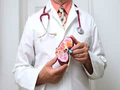 Kidney Transplant: Misconceptions And Truths One Should Be Aware Of