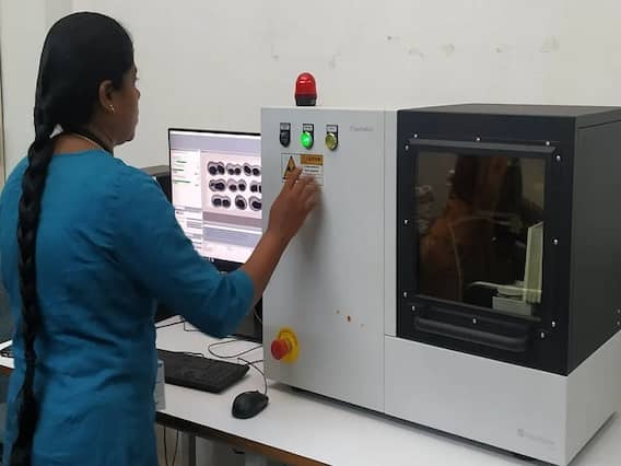 ਪੰਜਾਬ ਦੇ ਇਸ ਜ਼ਿਲ੍ਹੇ ਨੂੰ ਮਿਲੀ ਪਹਿਲੀ AI-ਐਕਸ ਰੇਅ ਮਸ਼ੀਨ, ਹੁਣ ਡਾਕਟਰਾਂ ਤੋਂ ਬਿਨਾਂ ਵੀ... ਪੰਜਾਬ ਦੇ ਇਸ ਜ਼ਿਲ੍ਹੇ ਨੂੰ ਮਿਲੀ ਪਹਿਲੀ AI-ਐਕਸ ਰੇਅ ਮਸ਼ੀਨ, ਹੁਣ ਡਾਕਟਰਾਂ ਤੋਂ ਬਿਨਾਂ ਵੀ...