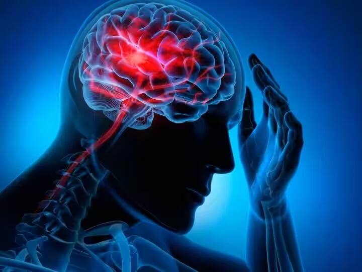 Delhi cold wave ncr sees surge in brain stroke cases know early symptoms Winter Health tips: ઠંડીમાં વધી રહ્યાં છે બ્રેઇન સ્ટ્રોકના કેસ, રક્ષણ માટે કરો આ નિયમ ફોલો, જાણો એક્સ્પર્ટે શું આપી સલાહ