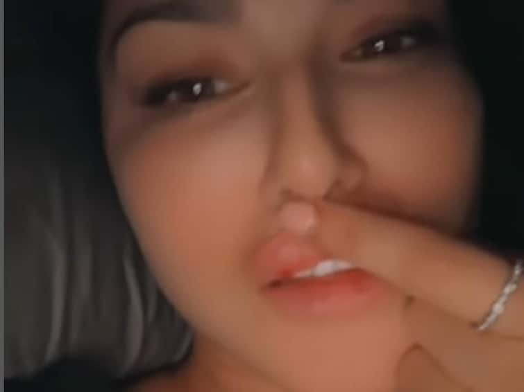 Sunny Leone's post about her lip injury and the strange reason behind it is going viral on social media. சன்னி லியோன் உதட்டில் ஏற்பட்ட காயம்.. இதுதான் காரணமா? வைரலாகும் பதிவு..