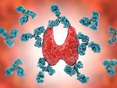 Know What Auto-Immune Diseases Are All About