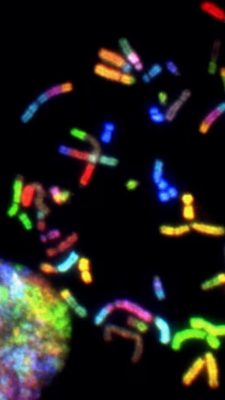 இவர்களின் உடல் பருமனுக்கு முக்கிய காரணம் மரபுதான்