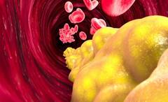 Health Tips: এই শীতে জীবনযাত্রায় সামান্য পরিবর্তন, তাহলেই নিয়ন্ত্রণে থাকবে কোলেস্টেরল