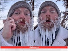 कड़ाके की ठंड में घर से बाहर निकला शख्स, चेहरे पर ही जम गई बर्फ... कभी देखा है ऐसा नजारा?