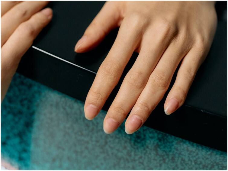 Zinc Deficiency Is The Reason For White Spots On Nails White Spots On Nails: మీ గోళ్ల మీద తెల్లటి మచ్చలు ఉన్నాయా? మీలో ఈ సమస్య ఉన్నట్లే!