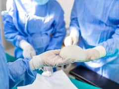 घुटनों तक बड़े ब्रेस्ट से परेशान थी महिला, 11 किलो था वजन, अब ऐसे बदली जिंदगी