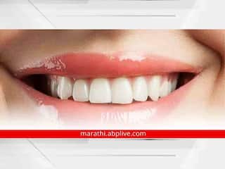 Health Tips : दात काढणे हा किडलेल्या दातांवरचा कायमचा उपाय असू शकतो का? मग उपाय काय? वाचा तज्ज्ञांचा सल्ला