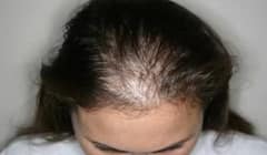 ਵਾਲਾਂ 'ਚ ਕੱਚਾ ਦੁੱਧ ਲਗਾਉਣ ਨਾਲ ਹੋਵੇਗਾ ਇਹ ਫਾਇਦਾ, ਇੱਕ ਵਾਰ ਜ਼ਰੂਰ ਕਰੋ ਟ੍ਰਾਈ