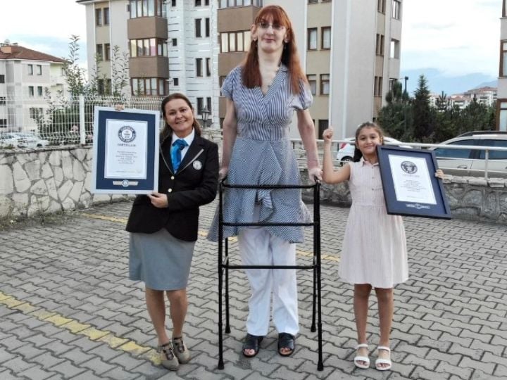 Rumesa is the tallest woman in the world due to disease her height increased ये हैं दुनिया की सबसे लंबी महिला, एक खास बीमारी की वजह से बढ़ गई इतनी हाइट