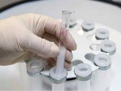 Norovirus: உஷார் மக்களே உஷார்..! கேரளாவில் பரவுகிறது நோரோ வைரஸ் - 19 பேருக்கு பாதிப்பு