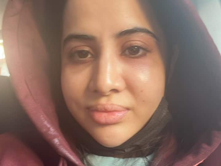 एलर्जी से ऐसी हो गई है Uorfi Javed की हालत, सूजा चेहरा देख लोगों ने बुलाया दूसरी राखी सावंत