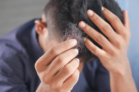 Coconut Oil for Hair Fall: Let's know the method of applying coconut oil and what are its benefits? Coconut Oil for Hair Fall: Let's know the method of applying coconut oil and what are its benefits?