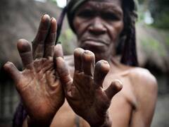 घर में किसी की मौत हो जाए तो काट दी जाती हैं महिलाओं की उंगलियां, इस कबीले में है अजीबो-गरीब परंपरा