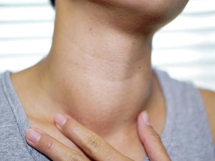 Hyper Thyroidism : ஹைப்பர் தைராய்டு பிரச்சனை உள்ளவர்களா? நிபுணர்கள் பரிந்துரைப்பது என்ன?