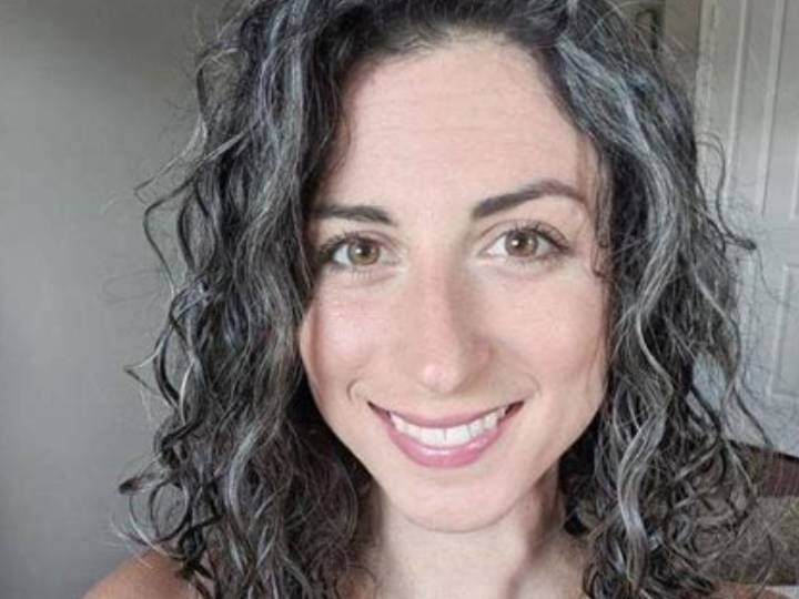 Vitamin C Deficiency May Leads To White Hair Grey Hair: इस Vitamin की कमी से वक्त से पहले होने लगते हैं सफेद बाल, बचने के लिए खाएं ये चीजें