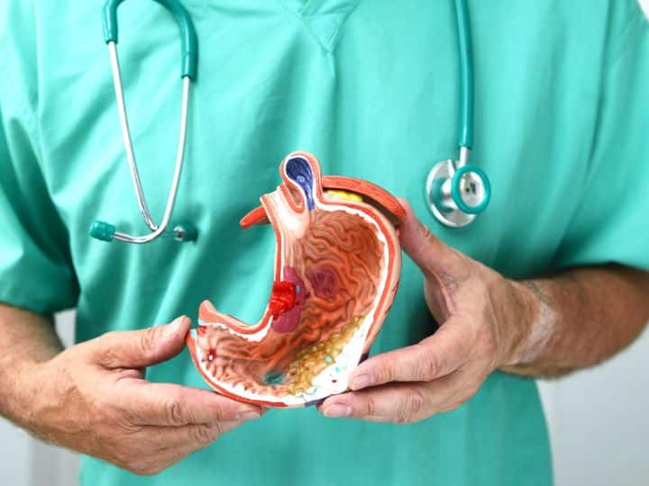 Bile Duct Cancer: 'बाइल डक्ट कैंसर' को पहचानने में न करें देरी, वरना फैल सकती है ये खतरनाक बीमारी, जान लें लक्षण Cholangiocarcinoma Know Everything About Bile Duct Cancer Symptoms Treatment Bile Duct Cancer: 'बाइल डक्ट कैंसर' को पहचानने में न करें देरी, वरना फैल सकती है ये खतरनाक बीमारी, जान लें लक्षण