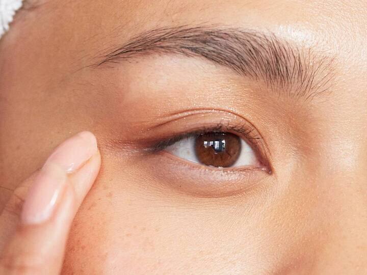 To overcome the problem of puffy eyes, follow these 7 home remedies