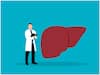 Fatty liver Disease: కాలేయం ఆరోగ్యంగా ఉందా? లేక కొవ్వు పేరుకుపోయిందా? తెలుసుకోవడం ఎలా