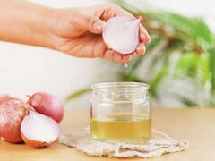 प्याज का तेल हेयर ग्रोथ से लेकर इन समस्याओं में भी है बहुत असरदार..आप भी जान लें