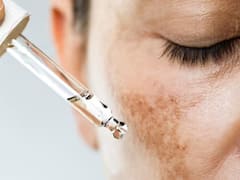 शराब का हैंगओवर तो उतर जाता है पर स्किन का हैंगओवर है बहुत खतरनाक, क्या आपको भी हैं ये सिंप्टम