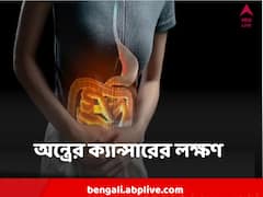 এই লক্ষণগুলি দেখে অর্শ বলে অবহেলা করছেন না তো? হতে পারে প্রাণঘাতী অন্ত্রের ক্যান্সারও
