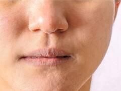 प्याज का तेल हेयर ग्रोथ से लेकर इन समस्याओं में भी है बहुत असरदार..आप भी जान लें