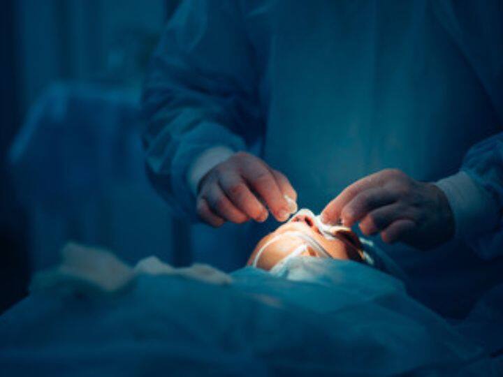 Rhinoplasty Woman Died Of 6 Cardiac Arrests After Nose Job Surgery Goes Wrong नाक की सर्जरी कराना पड़ा भारी, फेफड़े में भरा खून, 6 कार्डियक अरेस्ट के बाद महिला की मौत