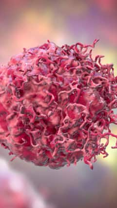 Cancer Prevention : ஆபாயகரமான புற்றுநோய் வராமல் தடுக்கமுடியுமா..மருத்துவர்கள் கூறும் அறிவுரை என்ன?