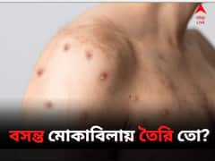 অশনি সঙ্কেত জলবসন্তের, মোকাবিলায় কী করবেন?