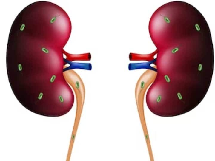 What will happen when both the kidneys of a person do not remain, is it possible to live?