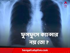 World Cancer Day 2023 : শুধু ধূমপান ছাড়লেই হবে না, ফুসফুসের ক্যান্সার এড়াতে এগুলোও করতে হবে