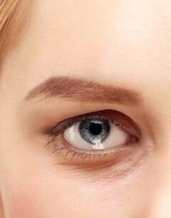 Dark Circle: ডার্ক সার্কেল নিয়ে জেরবার? হাতের কাছেই সমাধান, রইল টিপস