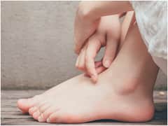 Cholesterol: శరీరంలో చెడు కొలెస్ట్రాల్ ఎక్కువైతే మీ గోళ్ళు చెప్పేస్తాయ్