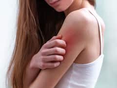 गोरे लोगों को स्किन कैंसर का सबसे ज्यादा खतरा, जानें कैसे कर सकते हैं अपना बचाव