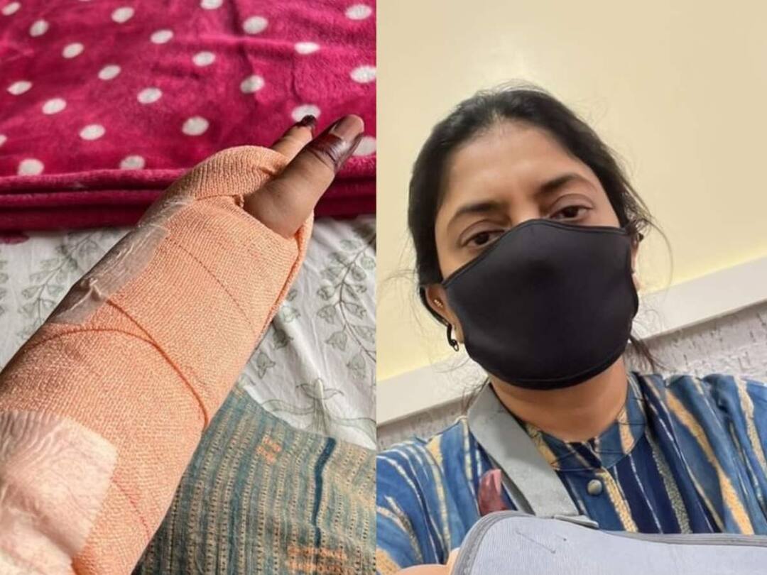 Star director Sudha Kongara got injured during shooting Sudha Kongara Injured: షూటింగ్‌లో తీవ్రంగా గాయపడ్డ డైరెక్టర్ సుధ కొంగర, డాక్టర్లు ఏం చెప్పారంటే?