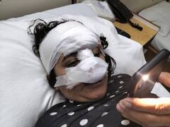 नोएडा में लुटेरों के हौसले बुलंद, लूटपाट का विरोध करने पर चलती बाइक से युवती को दिया धक्का