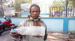 স্ত্রীকে কামড়েছিল সাপ, বোতলবন্দি করে হাসপাতালে ছুট স্বামীর