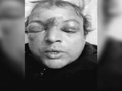 बांका में नकल की छूट चाहते थे परीक्षार्थी, सख्ती की तो मजिस्ट्रेट का नाक-मुंह फुलाया, एक गिरफ्तार