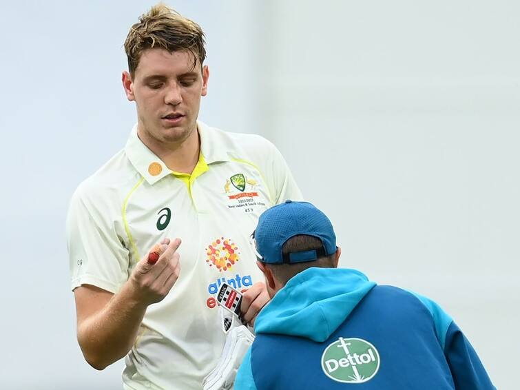 Cameron Green unlikely to play first Test against India in Border Gavaskar Trophy series Border Gavaskar Trophy: நானும் கிளம்புறேன்.. ஆஸ்திரேலியாவில் நீளும் காயமடைந்த வீரர்களின் பட்டியல்.. இந்தியாவிற்கு சாதகமா?