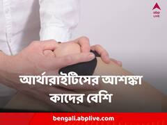 কাদের আর্থারাইটিসে আক্রান্ত হওয়ার আশঙ্কা বেশি? পার পাবেন না কমবয়সীরাও