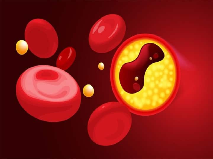 Vitamin Deficiency Reduces Red Blood Cells Affects The Nervous System Know What Are The Symptoms Associated With It