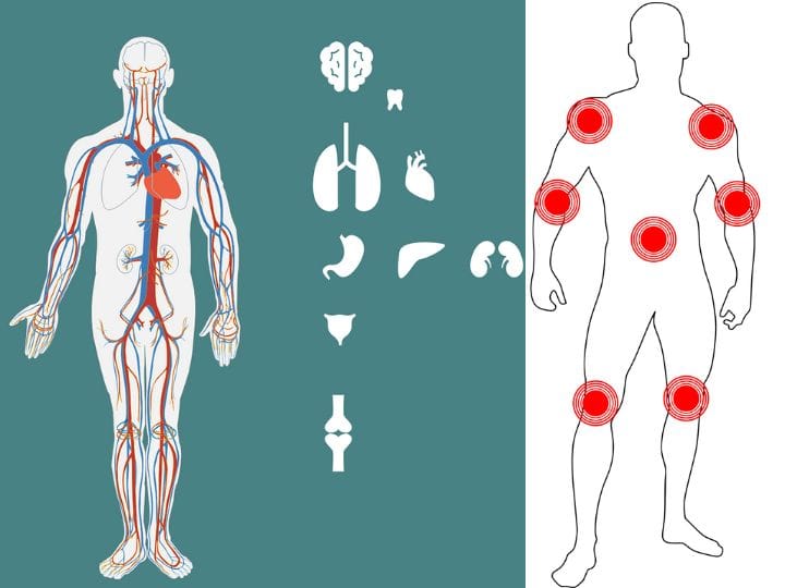 how to control arthritis pain best diet for arthritis patients how to prevent arthritis pain 80% अर्थराइटिस सिर्फ हेल्दी डायट से ठीक हो सकती है... जान लें क्या खाना है बहुत जरूरी